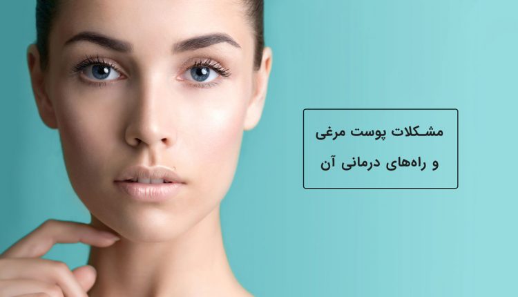 مشکلات پوست مرغی