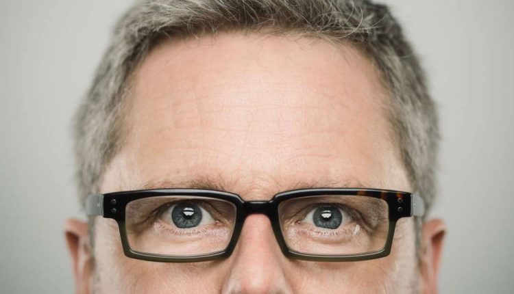 سفید شدن مو